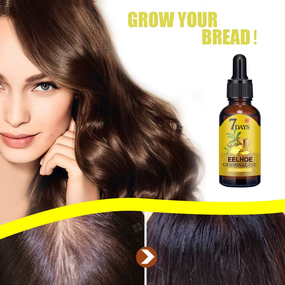 EELHOE Ginger Hair Growth Oil | Natural Essential Anti-Hair Loss Treatment | Hydrating Nutrient Solution for All Hair Types 40Ml